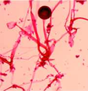Microscopic view of Rhizopus oryzae