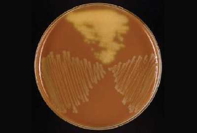Figure 11 is a picture showing growth of N. meningitidis on lower left, S. pneumoniae on top, and H. influenzae on lower right of a chocolate agar plate (CAP).