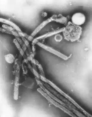 This negatively-stained transmission electron microscopic (TEM) image revealed the presence of a number of Hong Kong Flu virus virions, the H3N2 subtype of the Influenza A virus. Note the proteinaceous coat, or capsid, surrounding each virion, and the hemagglutinin-neuraminidase spikes, which differ in terms of their molecular make-up from strain to strain.