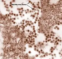 This is a digitally-colorized transmission electron microscopic (TEM) image revealed the presence of West Nile virus (WNV) virions, in an isolate that was grown in a cell culture.