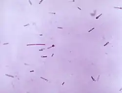 Photomicrograph of Gram-positive, Clostridium tetani bacteria. Note that several of these organisms had entered their endospore phase, assuming the characteristic tennis racket-type morphology.