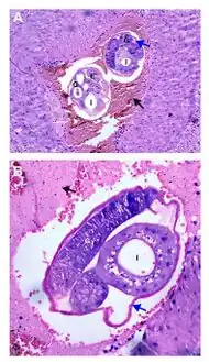 a,b)Adult female worms cross-sectioned at different levels are observed