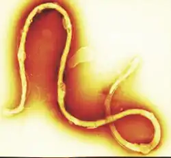 Borrelia burgdorferi is a spirochete, a class of long, slender bacteria, infection with the bacterium causes Lyme disease.