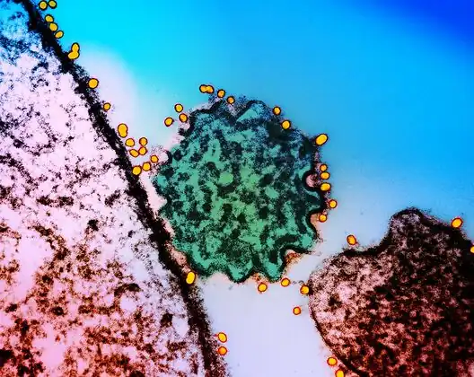 Transmission electron micrograph of a single Nipah virus particle  green that has budded from the surface of an infected cell pink. Nipah virus surface glycoproteins have been labeled using a technique called “immunogold labeling,” in which gold particles  are bound to antibodies that recognize a specific viral antigen or epitope, which then bind to that individual virus species both within and on the surfaces of infected cell