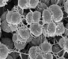 Phenotypic variants of N. gonorrhoeae