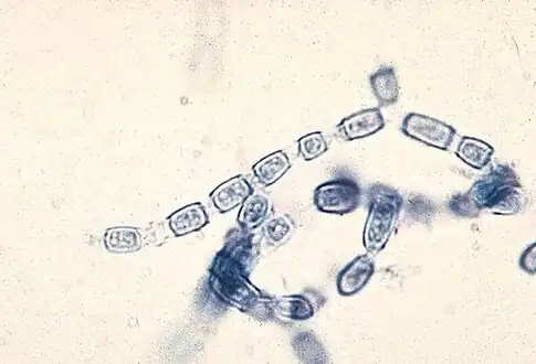 Septate hyphae of Coccidioides immitis with 90 degree branching and thick walled barrel shaped arthroconidia alternating with empty cells