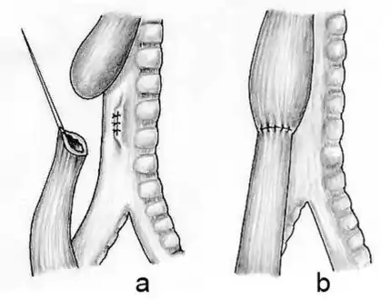 Schematic representation