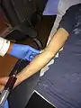 Blood drawn from patient