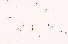 Flagellated "Bordetella bronchiseptica"