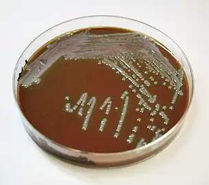 Chocolate agar showing Francisella tularensis colonies