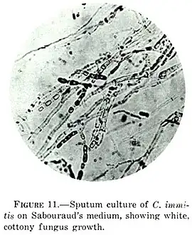 Sputum culture of Coccidioides immitis on Sabouraud's medium, showing white, cottony fungus growth