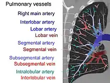 On CT scan, pulmonary emboli can be classified according to level along the arterial tree.