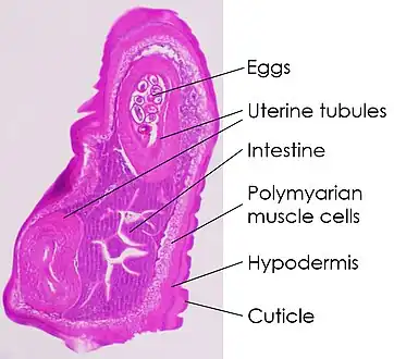 Cross-section of whipworm on microscopy