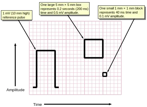 Measuring time and voltage with ECG graph paper