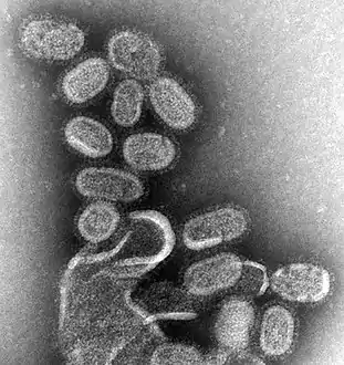 A transmission electron micrograph (TEM) of the reconstructed 1918 pandemic influenza virus. The bottom structure represents membrane debris from the cells used to amplify the virus. Pictured are the 'elliptical' particles representing the smallest particles produced by influenza virus. Purification techniques often deform the particles without proper fixation protocols, leading to 'spherical' appearance. (Filamentous or intermediate sized particles simply extend along the long axis on the opposite side of the genome segments.)