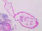 Partially longitudinal cross-section of Enterobius vermicularis, H&E stain