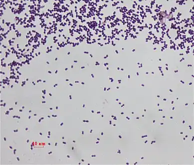 This is a Gram stain for Enterococcus faecalis under 1000 magnification (bright field microscopy)