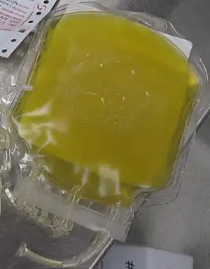 Photograph of a bag containing one unit of fresh frozen plasma