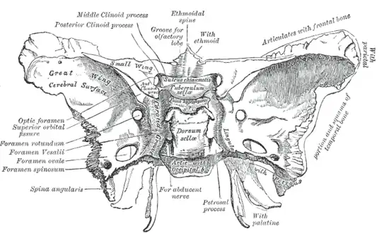 Surgical approach for removal is transsphenoidal at the base of the skull.