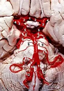 Human brainstem blood supply description. PICA is#12.