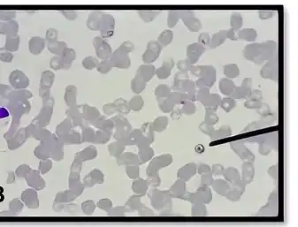 Species of Plasmodium falciparum identified using Giemsa stain