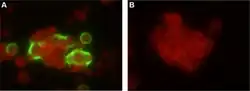 Adenovirus in the HEp-2 cells derived from swab samples (by indirect immunofluorescence assay).