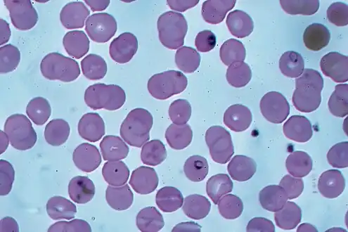 Ring forms in red blood cells (Giemsa stain)