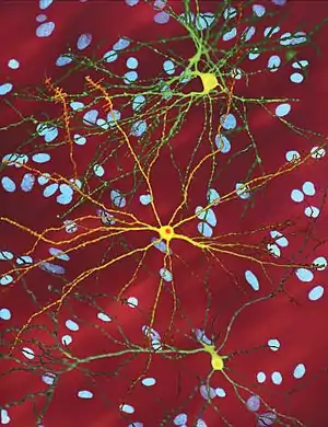 Several neurons colored yellow and having a large central core with up to two dozen tendrils branching out of them, the core of the neuron in the foreground contains an orange blob about a quarter of its diameter