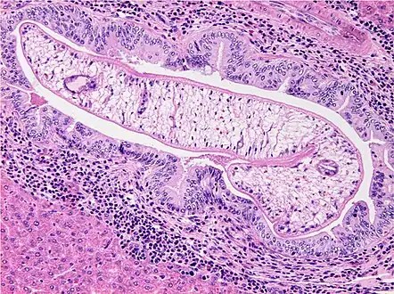 Photomicrograph of an adult O. viverrini in bile ducts of experimentally infected hamster