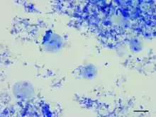 Dientamoeba fragilis trophozoites