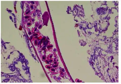 Longitudinal section through the larval stage of female pinworm (with numerous eggs)