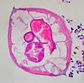 High magnification micrograph of a pinworm in cross section in the appendix, H&E stain