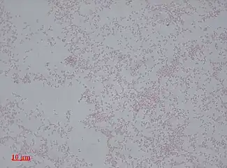 Proteus mirabilis appears as Gram-negative rods after Gram staining under bright-field microscopy with 1000 times magnification.