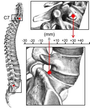 Sagittal balance measurement.