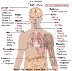 Main side effects of tramadol: Red color denotes more serious effects, requiring immediate contact with health provider.