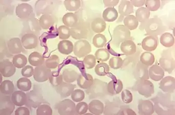 T. cruzi trypomastigotes seen in a blood smear