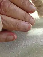 Terry's nails