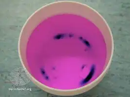 Potassium permanganate/therapeutic solution