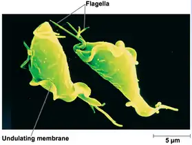 "T. vaginalis" Colorized SEM