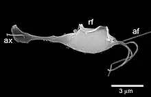 Trichomonas vaginalis observed by scanning electron microscopy