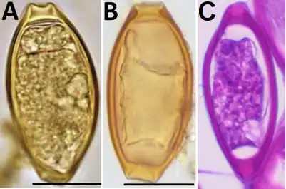 Eggs of Trichuris trichura. Image C shows HE stain.