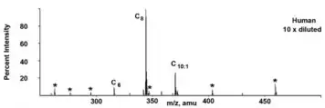 Acylcarnitine profile of an individual with MCADD, showing characteristic elevation of octanoylcarnitine (C8)