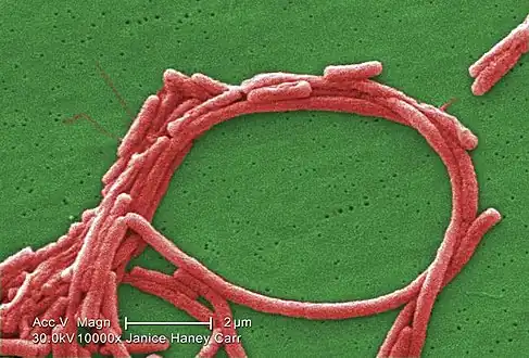 Magnified 10000X, digitally colorized scanning electron microscopic (SEM) image shows a group of Legionella pneumophila bacteria; some seemed to display flagella emanating from their cell walls, and some exhibited an elongated-rod morphology, which L. pneumophila are known to most frequently exhibit when grown in broth.