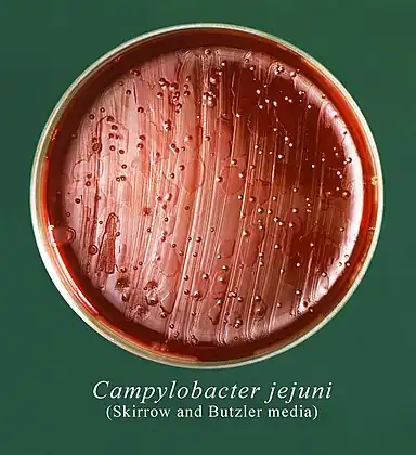 This Petri dish culture plate contained Skirrow and Butzler growth medium, which had been inoculated with a culture of Campylobacter jejuni, formerly known as Campylobacter fetus subsp. jejuni, and had produced numerous, small round bacterial colonies. Campylobacteriosis is an infectious disease caused by bacteria of the genus Campylobacter. Most people who become ill with campylobacteriosis have diarrhea, cramping, abdominal pain, and fever within 2 to 5-days after exposure to the organism.