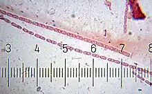 "Streptobacillus" Numbered ticks are 11 µm apart