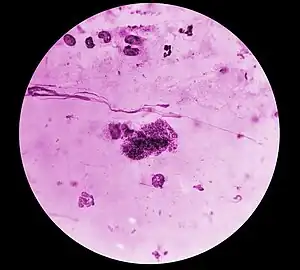 Rickettsia typhi bacteria