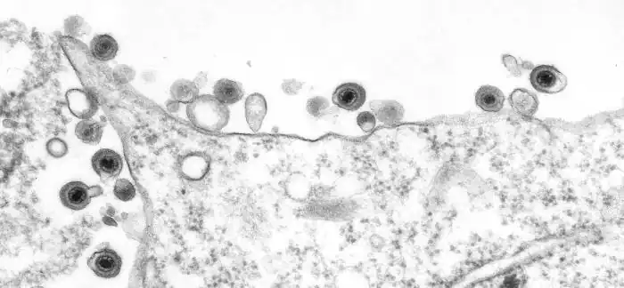 Electron microscopic image depicted numbers of human herpesvirus-8 (HHV-8) particle