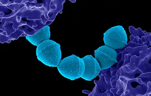 Colorized scanning electron micrograph of Group A Streptococcus (Streptococcus pyogenes) bacteria blue and a human neutrophil