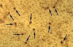 Under magnification of 50X, a McCoy cell monolayer culture, and that some of the cells exhibited Chlamydia trachomatis inclusion bodies. Using cell cultures from the McCoy cell line is one methods implemented in diagnosing Chlamydia infections.
