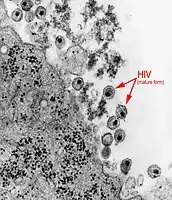 Transmission electron micrographic (TEM) of mature forms of the HIV.